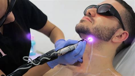 For men looking for full body permanent hair removal they could opt for three(3) methods : LASER HAIR REMOVAL FOR MEN | ALEX COSTA - YouTube