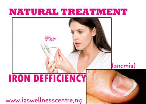EFFECTIVE NATURAL TREATMENT FOR IRON DEFICIENCY (ANEMIA ...