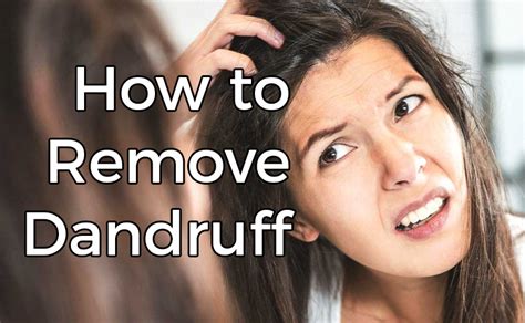 Dandruff is only a recent problem in our society because we have grown to think showering and scrubbing our hair 7 times a week is normal. how to remove dandruff #removedandruff in 2019 | Hair ...