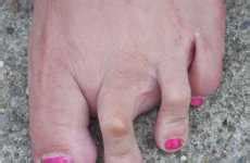 Another woman proudly shows off her camel toe tattoo in a post on twittercredit: Tattooed Camel Toes: Satirical Toettoos Are a Permanent ...