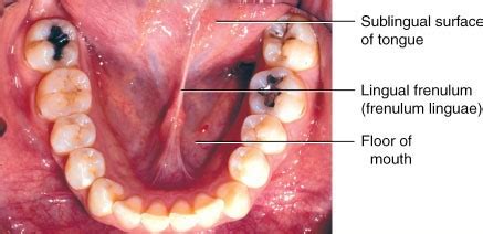 Maybe you would like to learn more about one of these? Case Report : Cosmetic-Esthetic Dentistry with Frenectomy ...