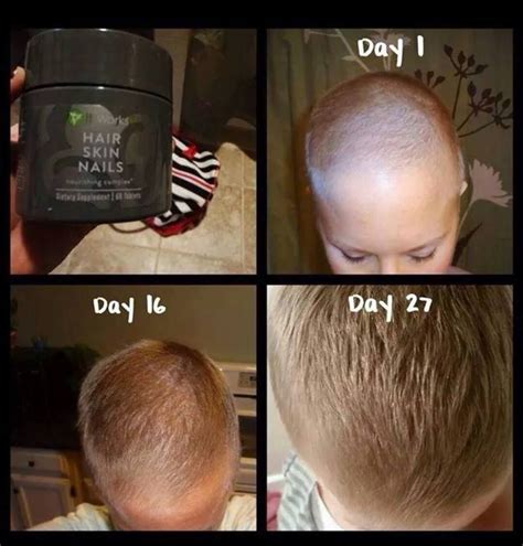 Skipping a wash or two allows natural oils (aka grease) to build up on your scalp. Coloring Hair After Chemo - NEO Coloring