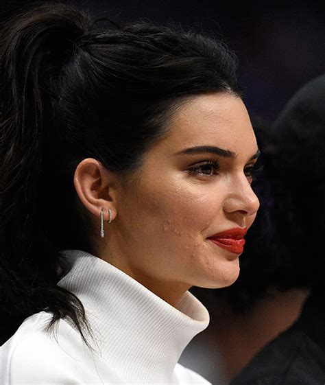 In 2019, plastic surgery and cosmetic procedures do not have the same type of stigma attached to them as they did 20 years ago. Kendall Jenner tiene un mensaje para los 'haters' que ...