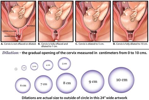 Late in pregnancy, the cervix may have already dilated several centimeters before a woman experiences any symptoms of labor. Effacement, Pelvic Station, Dilation - The Family Woman