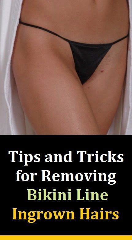 Gently apply a thick layer of skin so soft fresh & smooth sensitive skinâ bikini lineâ hair removal cream over hair to be removed. Tips and Tricks for Removing Ingrown Hairs on your Bikini ...