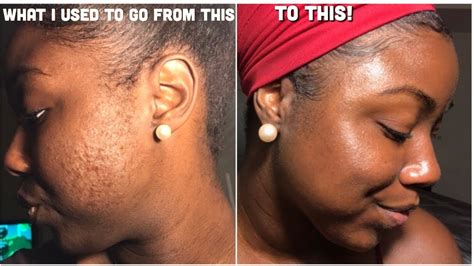 Drugstores are unfortunately full of skincare brands that test on animals. Skin Care Routine Drugstore Products - YouTube