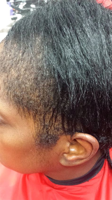 The active agent is usually a strong alkali, although some formulations are based on ammonium thioglycolate or formaldehyde. How To Repair Your Hair From Relaxer Damage | LaToya Jones