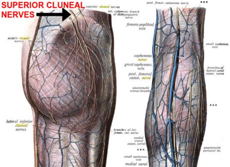 You may also feel a thickening of tissue along the rim of the posterior iliac crest, and there may be tenderness in this region. Adhesions of the Thoracolumbar Fascia as the Number One ...