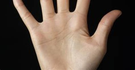 Some of these conditions include: Bumps on the Palm of a Hand | LIVESTRONG.COM