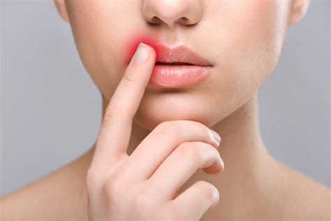 Herpes ist grundsätzlich ansteckend, egal ob lippenbläschen sichtbar sind oder nicht. Was ist Herpes? - Herpes erklärt | Gesundheute.net