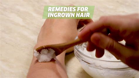 'using a naturally grainy exfoliant is one of the best treatments for removing ingrown hairs. How To Get Rid Of And Remove Ingrown Hair Easy! - YouTube
