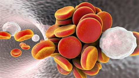 Müssen personen, die schon einmal eine thrombose hatten, zum beispiel in den. Weitere Thrombose-Fälle nach Impfung mit Astrazeneca ...