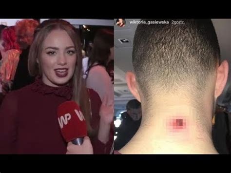 Ponadto grała również w takich serialach jak na. Gąsiewska broni wielkiej krosty Zdrójkowskiego: "Od razu ...