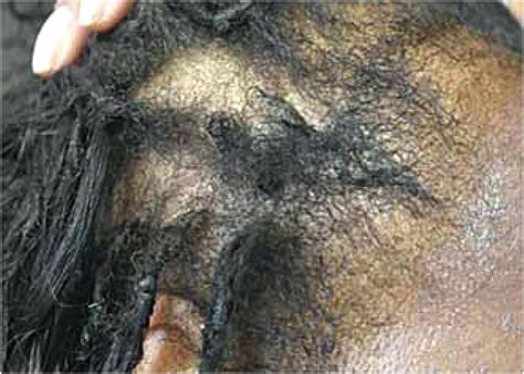 Pubic hair for the gen2 female. Pin di Simple Hairstyle