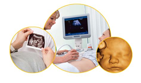 Early fetal scan (early baby scan) is an advanced version of nt scan. Nuchal dating | Nuchal translucency scan (NT scan). 2019-07-26