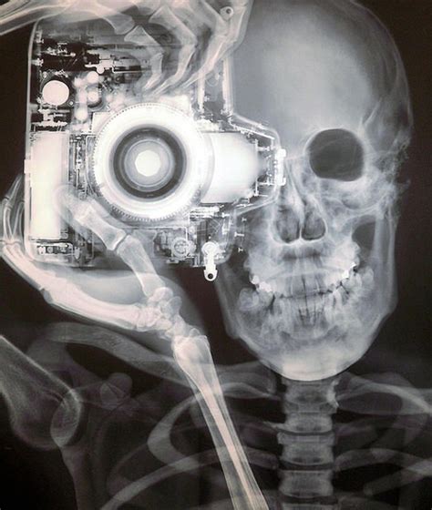 Check spelling or type a new query. X-Ray Image of Photographer and Camera by Nick Veasey