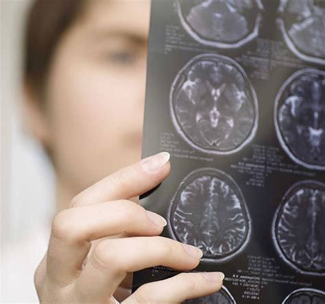 A sense of change brain tumors can cause seizures, but not just the types that cause you to lose consciousness and convulse. Q & A: Facts About Brain Tumors | Henry Ford LiveWell