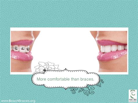 Being able to remove your aligners is both. Benefits of Invisalign #7 - Beach Braces - Orthodontic ...