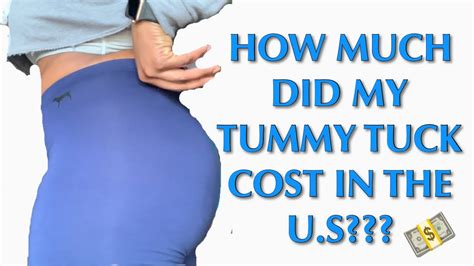 In general terms, the cost of an abdominoplasty includes the hospital stay, the doctor's fee, anesthesia charges and the costs of. HOW MUCH DID MY TUMMY TUCK COST | WHAT OUT OF POCKET ...