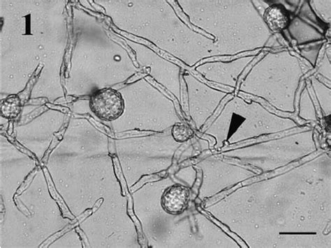 Mycelia, appressoria, and young ascomata of Brasiliomyces... | Download Scientific Diagram