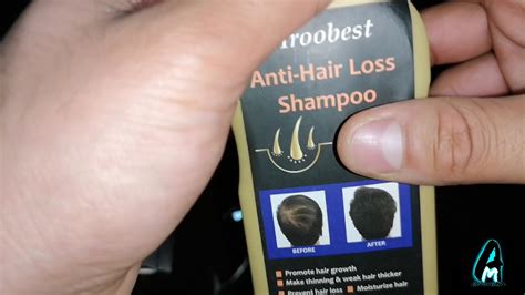 Let's separate cbd from hemp seed oil. Mroobest Anti Hair Loss Shampoo (Review) - YouTube