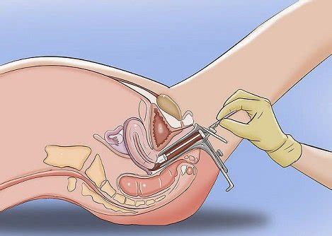 Pap tests can also identify the presence of certain vaginal or uterine infections, like trichomonas. Understanding Your Cervical Health: Pap Smears, HPV and ...