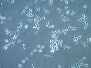 We did not find results for: MB49 Mouse Bladder Carcinoma Cell Line ≥1X10⁶ cells/vial ...