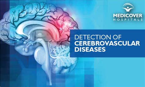 When blood flow to an area of the brain stops, oxygen and nutrients cannot get to that area of the brain. Detection of Cerebrovascular Diseases | Medicover Hospitals
