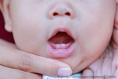 Wenn im alter von etwa sechs monaten sich im kiefer die ersten zähne ankündigen, können sie durchaus spielerisch mit der ersten mundhygiene beginnen. Der erste Zahn beim Baby