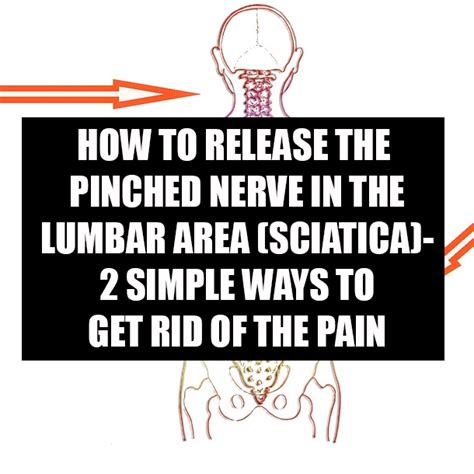 We work with your physicians to make sure our products pinpoint your ailments. HOW TO RELEASE THE PINCHED NERVE IN THE LUMBAR AREA ...