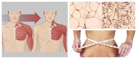 We did not find results for: Caquexia: ¿Qué Es? Causas, Síntomas, Factores De Riesgos y ...