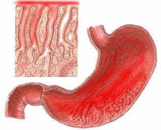 Острый гастрит диеты Clinical Manifestations of Acute Gastritis and Chronic Gastritis Clinical Manifestations of Acute Gastritis and Chronic Gastritis Острый гастрит диеты