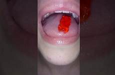 swallowing gummies