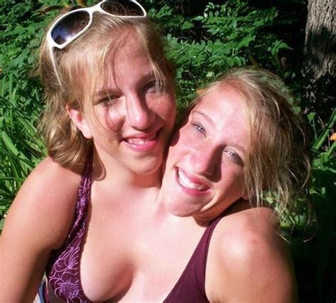 Abby and brittany hensel family, boyfriend, marriage and children: 15 Unbelievable Facts About World Famous Conjoined Twins ...