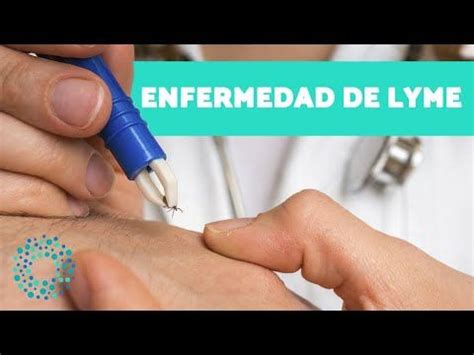 Es fácil que una picadura de garrapata pase desapercibida. ¿Qué es la ENFERMEDAD DE LYME? - Causas, síntomas y ...