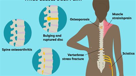 Memorize all the muscle facts with the help of muscle cheat sheets. Anatomical Name Of Lower Back Muscles - Amazon Com Labeled Anatomy Chart Of Male Lower Back ...