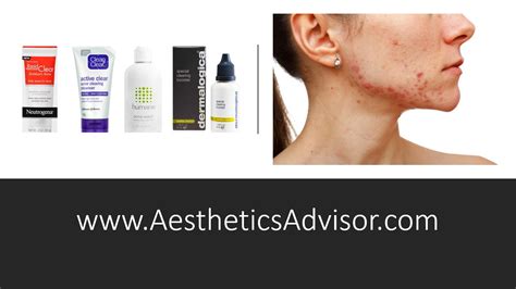 Learn the types & causes of acne. Best Benzoyl Peroxide Acne Treatments in Malaysia 2020 ...