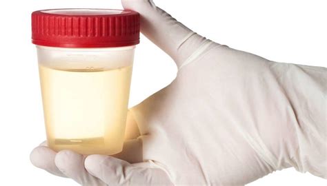 Urine usually has a light odor, but bad smelling urine can be due to dehydration or an infection in your urinary tract. Urine smells like ammonia: Causes, treatments, and symptoms