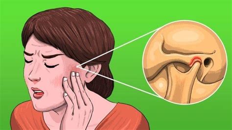 Bahkan sakit gigi bisa menyebabkan sakit di bagian kepala hingga rasanya menyiksa sampai tak nafsu makan. Bahan Alami Untuk Atasi Sakit Gigi, Kenali Penyebab Gigi ...