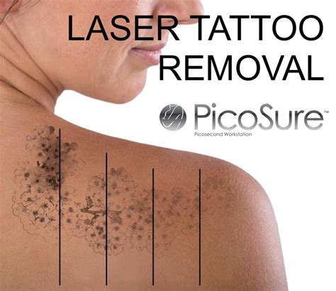 Maybe you would like to learn more about one of these? Picosure Laser Tattoo Removal | Dr Joney De Souza | London