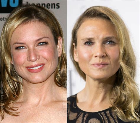 Zellweger started her career by plain minor roles in the films; Renee Zellweger calls plastic surgery rumors a nefarious truth