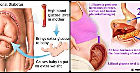 Perkataan 'diabetes' atau kencing manis bukan satu istilah asing. KENCING MANIS KETIKA HAMIL JOM ELAK KENA CUCUK INSULIN.