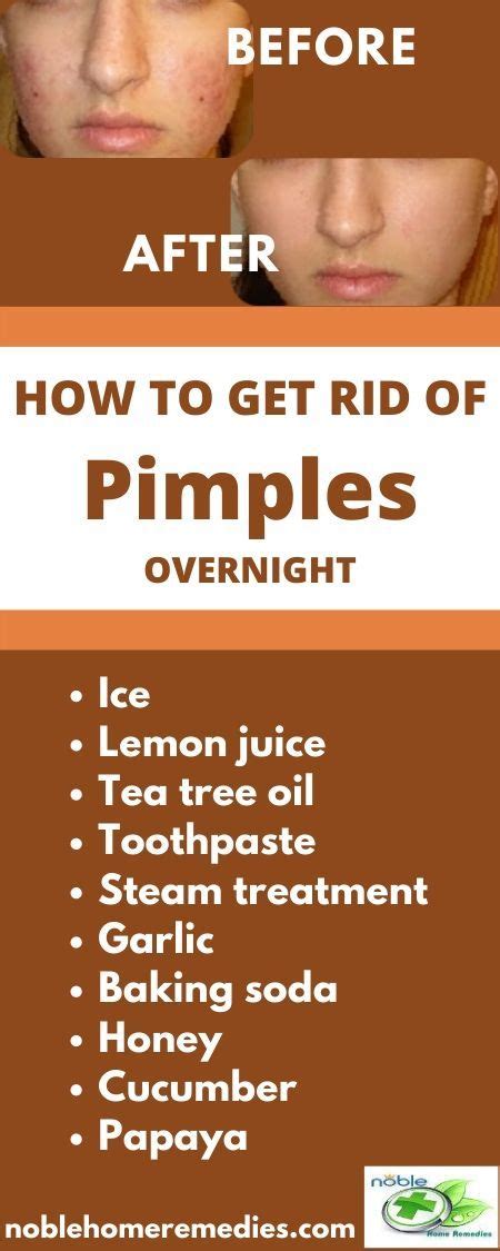 Walmart.com has been visited by 1m+ users in the past month How to get rid of pimples fast? in 2020 | Natural remedies ...