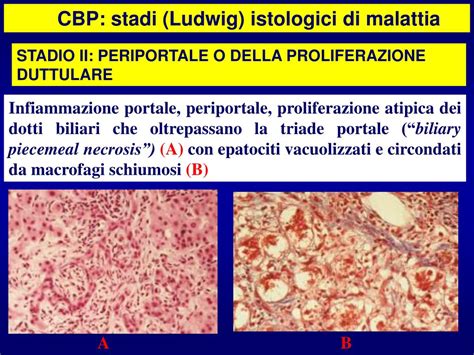 PPT - Malattie delle vie biliari PowerPoint Presentation ...