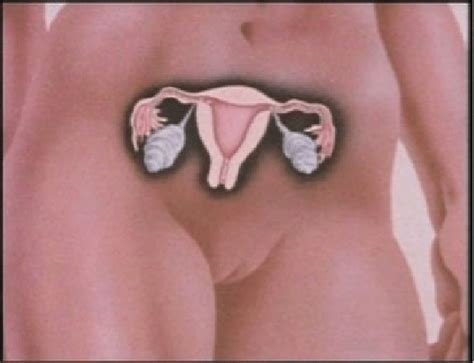Chapter 21 female reproductive system. Diagram of the female reproductive system from 'To Mrs ...