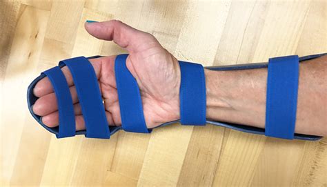 To be a little more descriptive about the strain, basically it hurts from my palm down my wrist in the tendon when force is applied on my ring finder in an open handed grip. Left Leg Flexor Tendon Location - The muscle belly forms a ...