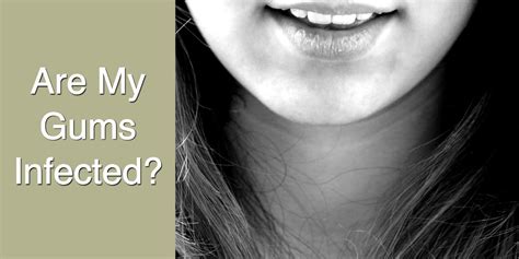 Paddlereport: Why Do My Gums Itch With Braces