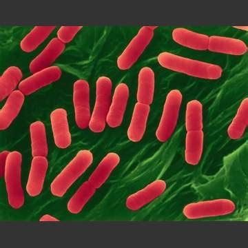 Distrugerea bacteriei e coli 05.02.2020 | admin totuși, aplicând metode eficiente de prevenire a bacteriei e. Epidemia E. Coli: De ce nu este suficient sa spalam ...