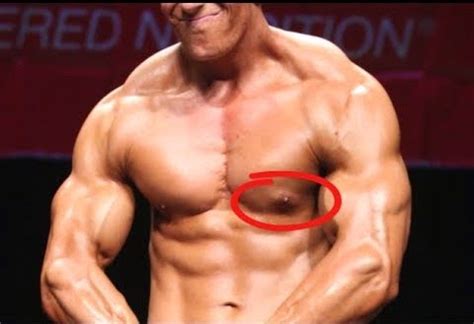 And yes, just skip the steroids and take other supplements. Men's Health and Andrology: Prolactin-induced gynecomastia ...