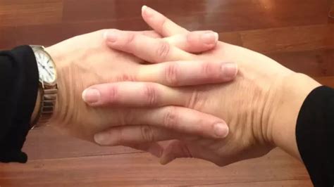 Fatty tumors can feel nodular and a little rubbery. Why does cracking your knuckles feel good? - Quora